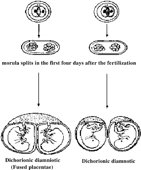 Investigating The Rare Occurrence of Male-Female Conjoined Twinning: Incomplete Embryonic Division with Divergent Sexual Differentiation, Symmetrical Conjoined Twins Opposite Phenotypic Sex - Issue cover