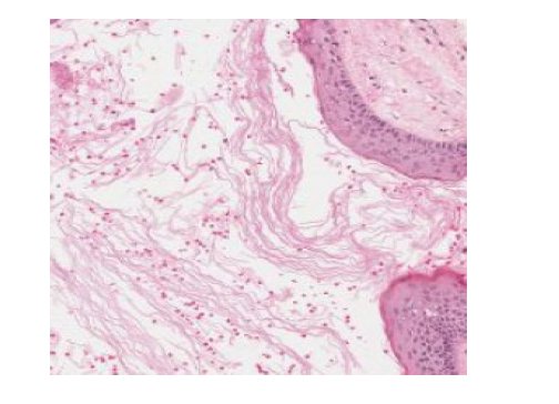 Gorlin-Goltz Syndrome - Case Report and Literature Review Emphasizing on Diagnostic Methods - Issue cover
